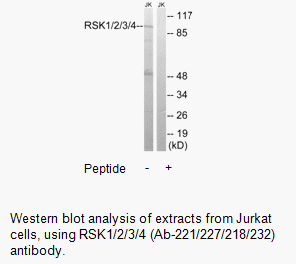 Product image for RSK1/2/3/4 (Ab-221/227/S218/232) Antibody