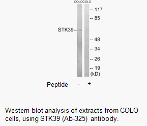Product image for STK39 (Ab-325) Antibody
