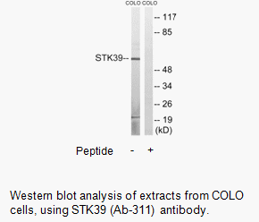 Product image for STK39 (Ab-311) Antibody