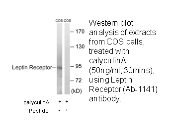 Product image for Leptin Receptor (Ab-1141) Antibody