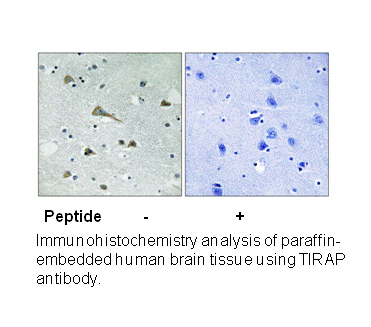 Product image for TIRAP (Ab-86) Antibody