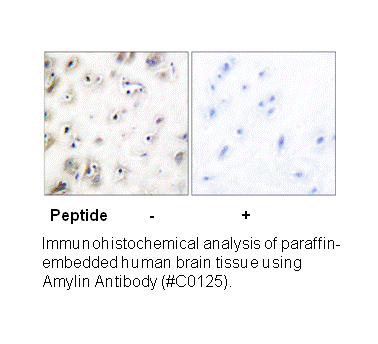 Product image for Amylin Antibody