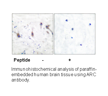 Product image for ARC Antibody