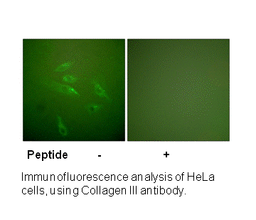 Product image for Collagen III Antibody