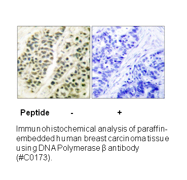 Product image for DNA Polymerase &beta; Antibody