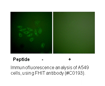 Product image for FHIT Antibody