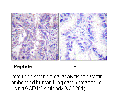 Product image for GAD1/2 Antibody