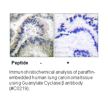 Product image for Guanylate Cyclase &beta; Antibody