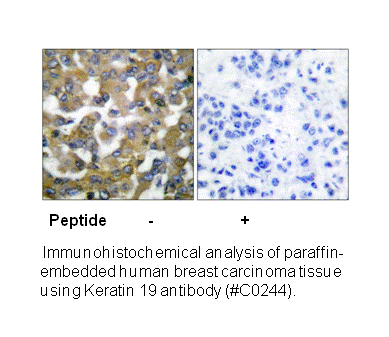 Product image for Keratin 19 Antibody