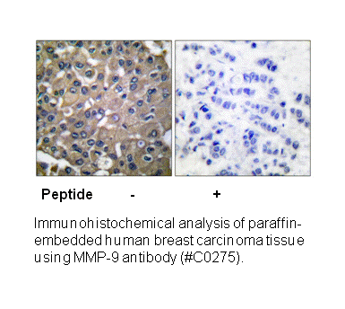 Product image for MMP-9 Antibody