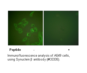 Product image for Synuclein &beta; Antibody