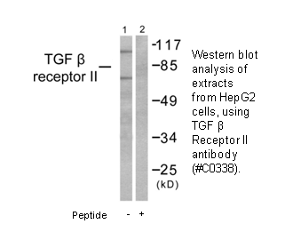 Product image for TGF &beta; Receptor II Antibody