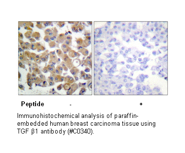 Product image for TGF &beta;1 Antibody