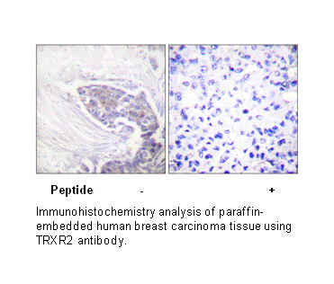 Product image for TRXR2 Antibody