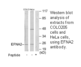 Product image for EFNA2 Antibody