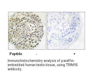 Product image for TRIM16 Antibody