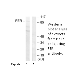 Product image for FER Antibody