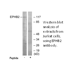 Product image for EPHB2 Antibody