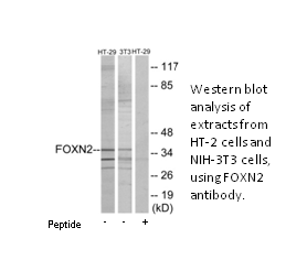 Product image for FOXN2 Antibody