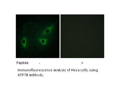 Product image for ATP7B Antibody