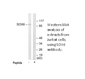 Product image for SOX6 Antibody