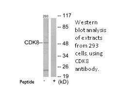 Product image for CDK8 Antibody