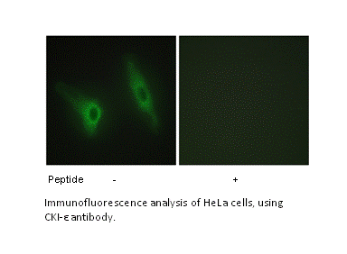 Product image for CKI-&epsilon; Antibody