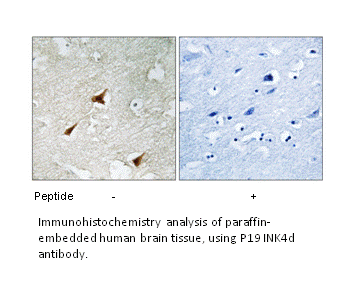 Product image for p19 INK4d Antibody