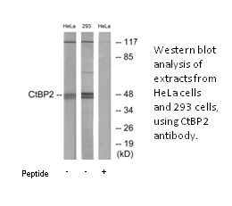 Product image for CtBP2 Antibody