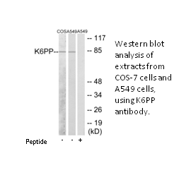 Product image for K6PP Antibody