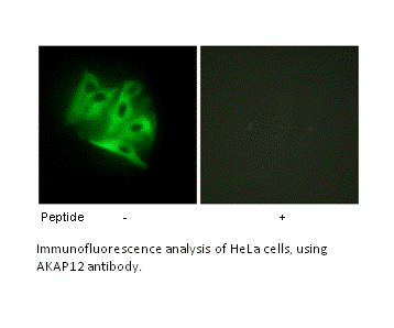 Product image for AKAP12 Antibody