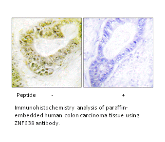 Product image for ZNF638 Antibody