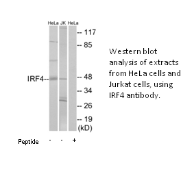 Product image for IRF4 Antibody