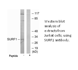 Product image for SURF1 Antibody