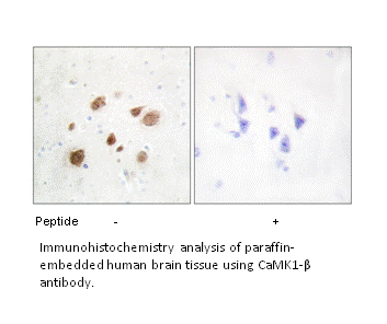 Product image for CaMK1-&beta; Antibody