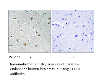 Product image for F111B Antibody