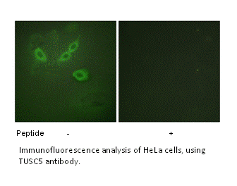 Product image for TUSC5 Antibody