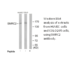 Product image for SMRC2 Antibody