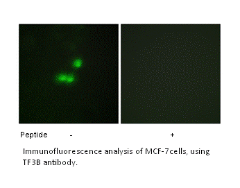 Product image for TF3B Antibody