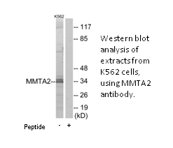 Product image for MMTA2 Antibody