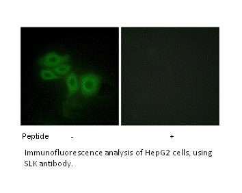 Product image for SLK Antibody