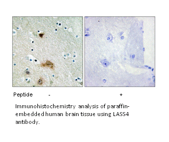 Product image for LASS4 Antibody