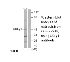 Product image for CKI-&gamma;1 Antibody