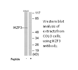 Product image for IKZF3 Antibody