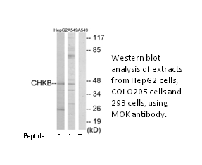 Product image for CHKB Antibody