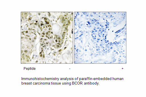 Product image for BCOR Antibody