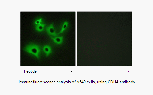 Product image for CDH4 Antibody