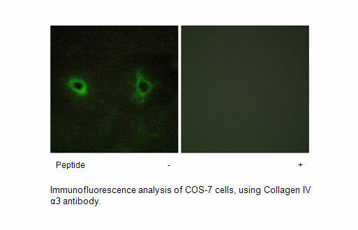 Product image for Collagen IV &alpha;3 Antibody