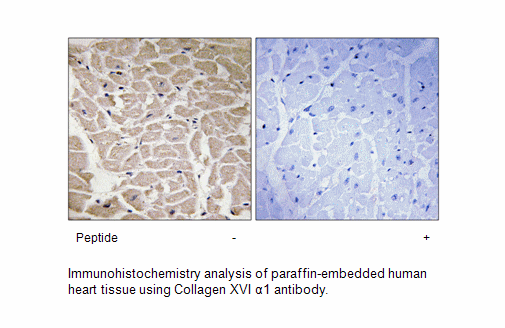 Product image for Collagen XVI &alpha;1 Antibody