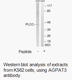 Product image for AGPAT3 Antibody